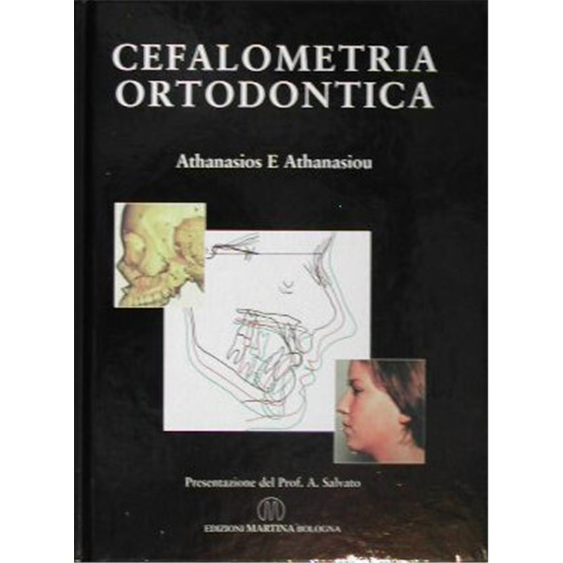 Cefalometria ortodontica